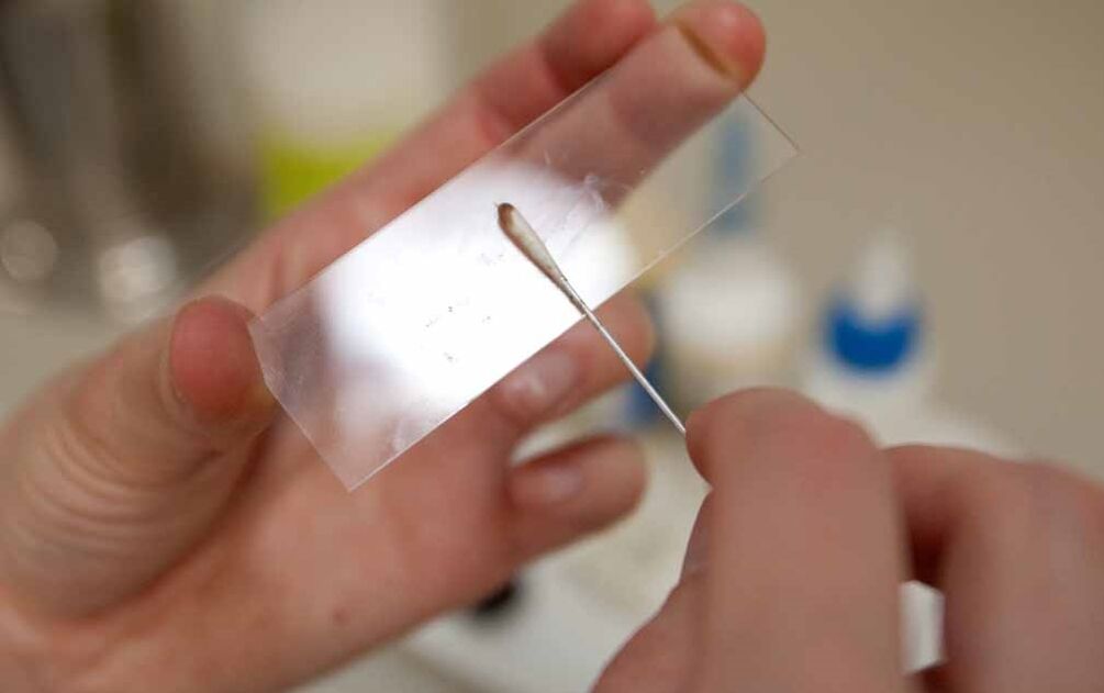Gratter pour la présence de parasites dans le corps