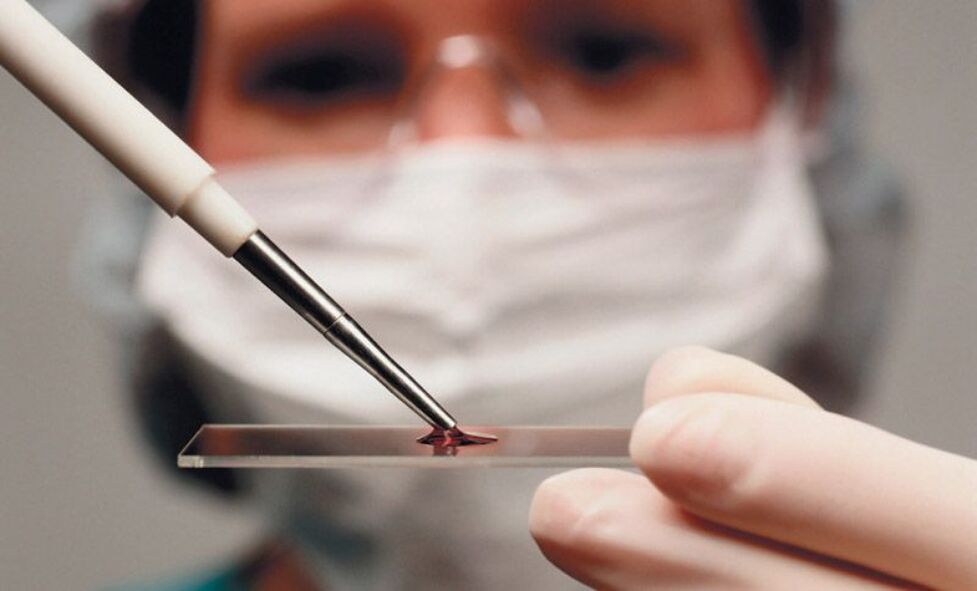 Test sanguin pour les parasites