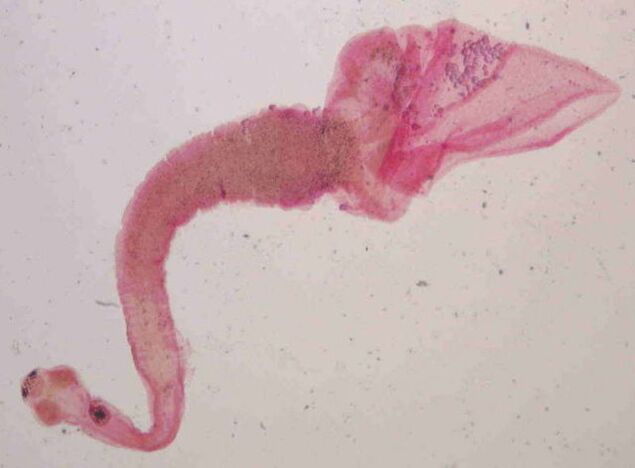 Ténia du porc provenant de l'homme