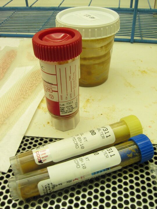 Tests pour détecter les parasites